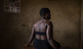 RDC. Les atteintes aux droits humains effrénées commises par les ADF contre des civil·e·s sont des « crimes de guerre que le monde ne saurait continuer d’ignorer » – nouveau rapport